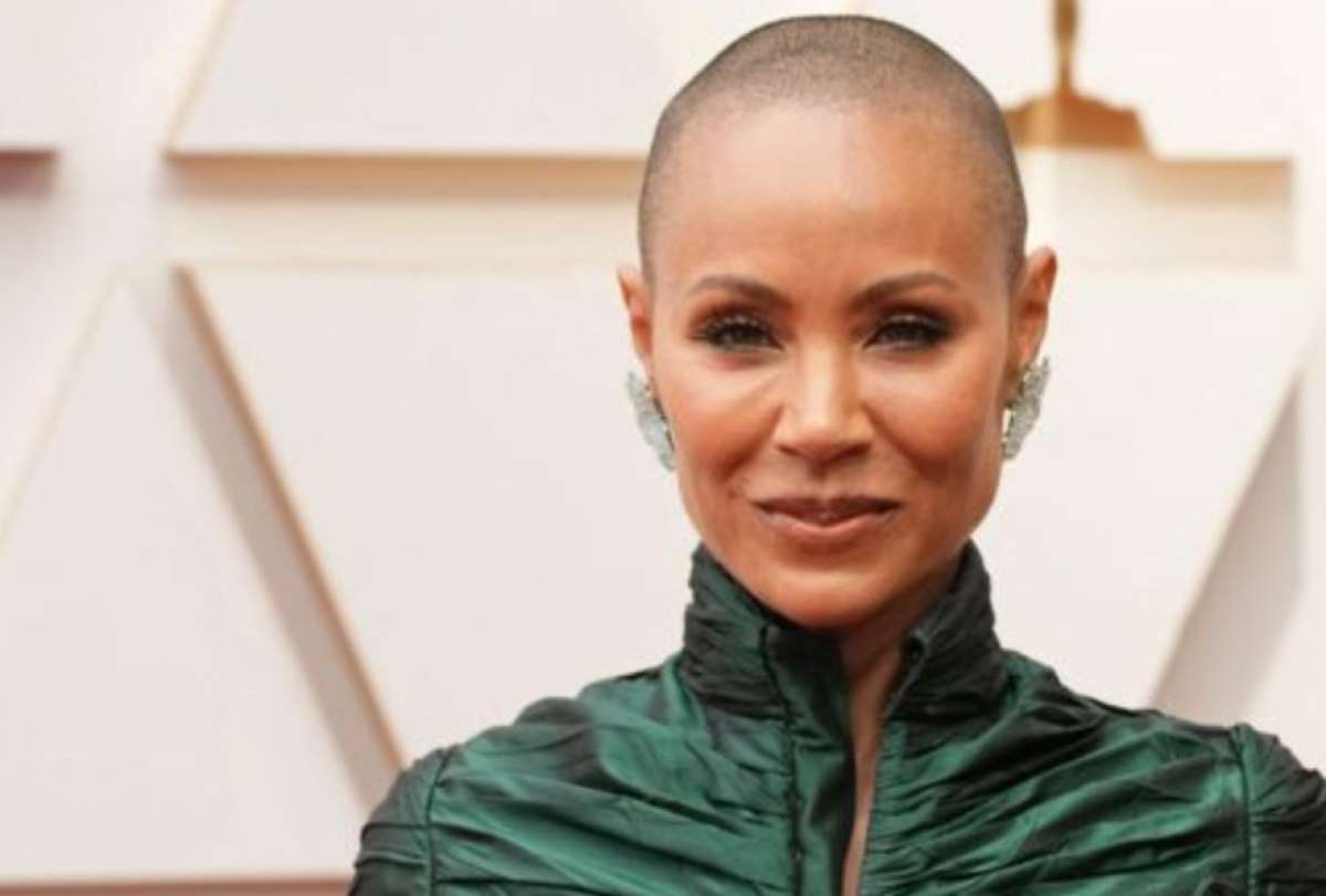 El Telégrafo - Premios Oscar 2022: Jada Pinkett Smith y su lucha contra la  alopecia