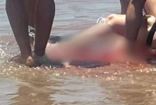 Una mujer resultó herida en su pantorrilla por un ataque de tiburón en la isla del Padre.
