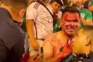 El video del hincha agredido se volvió viral